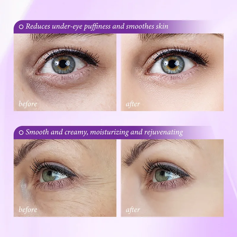 Instant Eye Bag Removal Cream  - огляд і ціна Skincare D'Alba