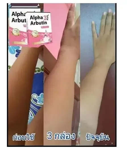 Alpha Arbutin 3 Plus Powder Mi - огляд і ціна Alpha Arbutin Serum